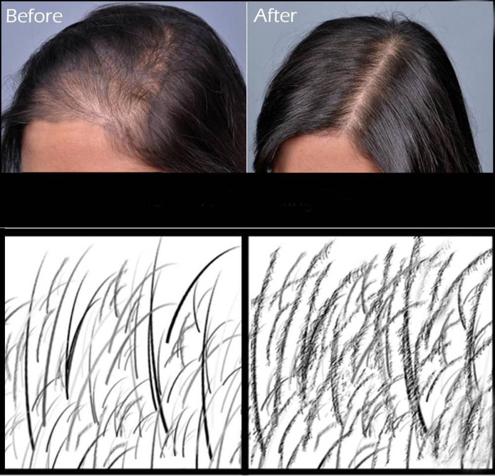 HairAgain 50g /100g Streuhaar Schütthaar Haarauffüller Haarverdichter Haarfasern